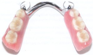 Photograph of a removable denture